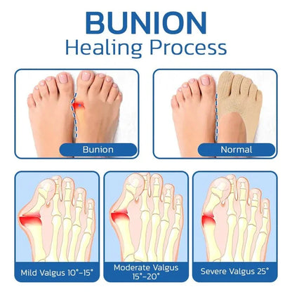 Anti Bunions Health Sock